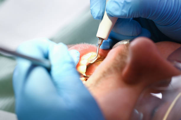 Best Urgent Dental Care in North Fort Lewis, WA