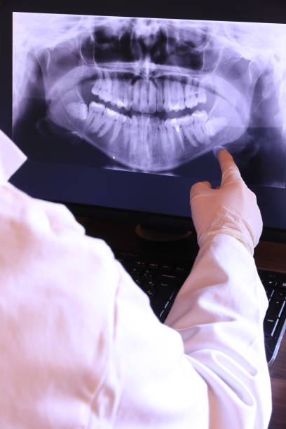 Best Emergency Wisdom Teeth Removal in North Fort Lewis, WA